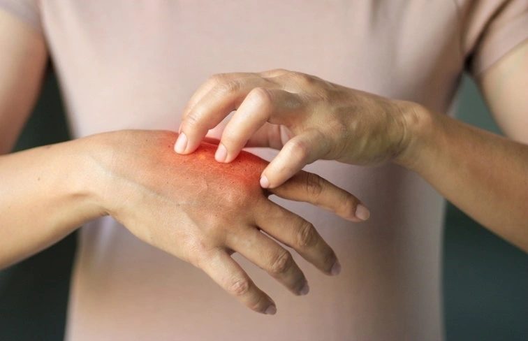 Textilallergia: mit okozhatnak a ruhák és lakástextilek?