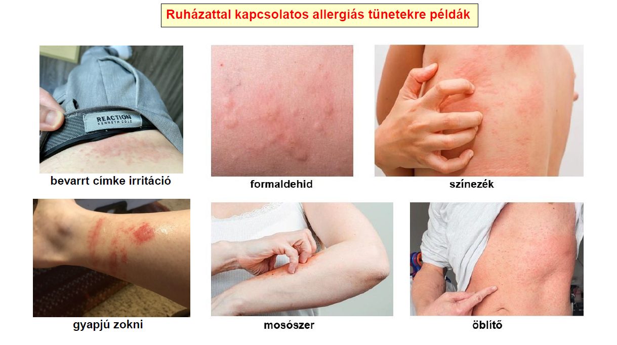 Különösen problémás anyagok